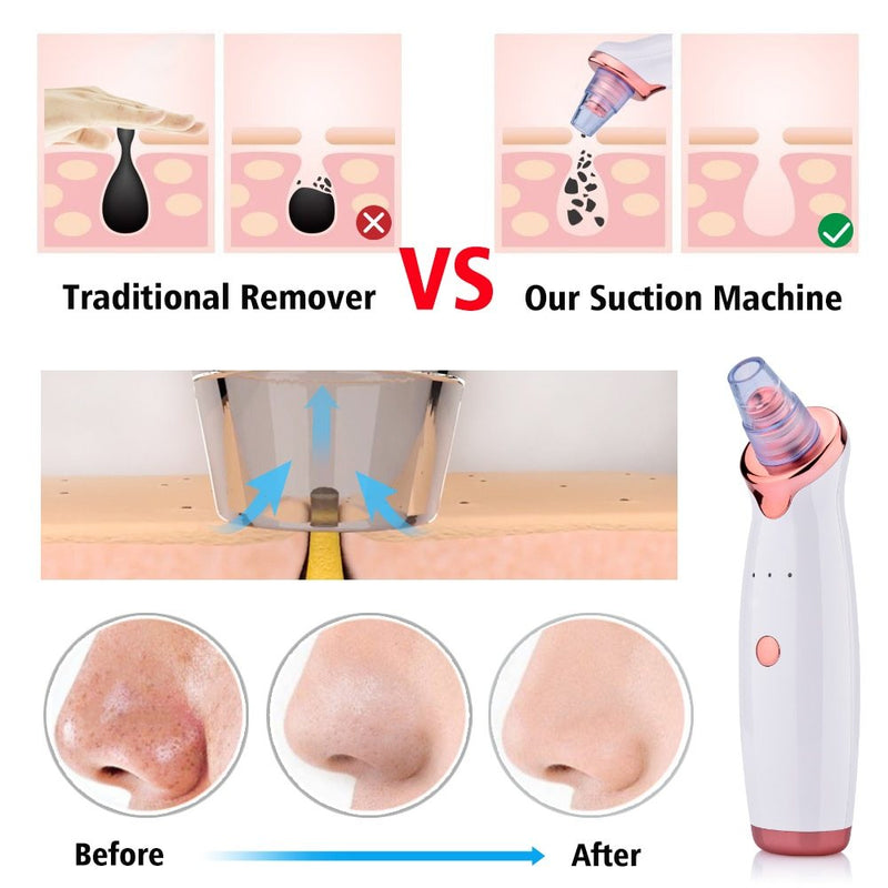 Load image into Gallery viewer, Blackhead Electric Suction Facial Washing Instrument Beauty Acne Cleaning
