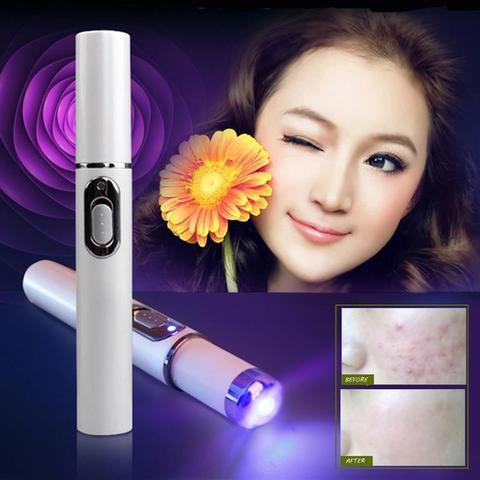 Load image into Gallery viewer, Blue Light Therapy Acne Laser Pen Soft Scar Wrinkle Removal Treatment
